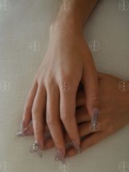 -清疣美疣·痣·斑净肤中心