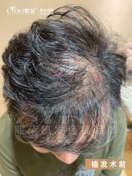 -熙朵美学植发·连锁品牌