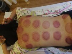 -传古推拿·古法按摩(义井路店)