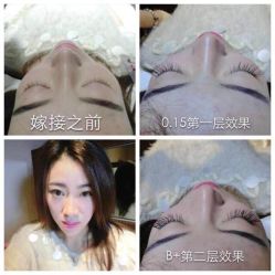 iphone_upload_pic-光SPA科技美肤