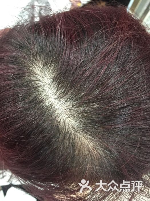 任美霖生发黑发上传的图片