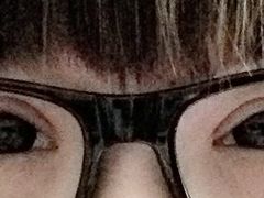 第三天-上海华安整形外科门诊部