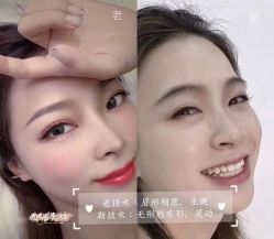 -西施无菌半永久纹绣眉眼影唇轻增发纹发际线