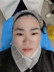 体验后-素妍医疗美容抗衰中心