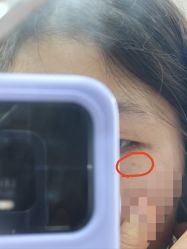 -成都军建医院·疤痕诊疗中心