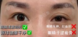 -LUNA皮相美·骨相美高级美感