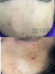 -蕾特恩专业祛痘·皮肤管理