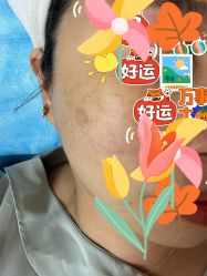 体验前-恒妍医美·韩国定制抗衰中心