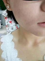 -MJ skin care国际皮肤管理中心