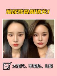 -Yestar宁波艺星整形医院