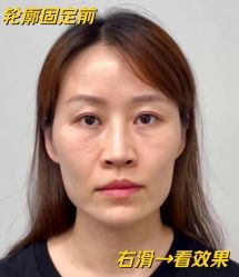点击看大图 -Yestar艺星医疗美容医院