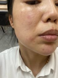 -上海玫瑰医疗美容医院