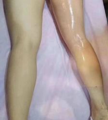 -YR·瘦身纤体
