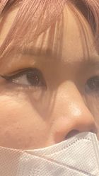 体验前-上海玫瑰医疗美容医院