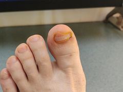 -新甲连锁灰指甲·甲沟炎·鸡眼(黑龙江路店)