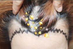 -大麦微针植发全国连锁