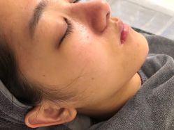 -瓷肌博士·祛痘科技美肤