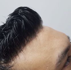 -发饰美男士增发补发假发定制店