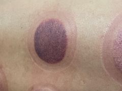 -体康盲人专业推拿