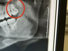 -上海市徐汇区口腔医院