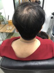 -髻尚坊增发补发织发假发定制