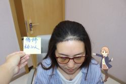 -大麦微针植发丨全国连锁