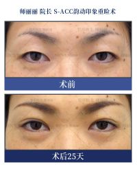 -丰联丽格医疗美容·联合丽格眼整形中心