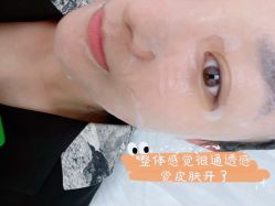 体验后-JS医疗美容