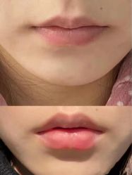 -上海漾颜医疗美容