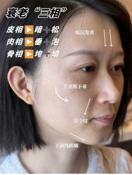 -半岛故事·法儿曼抗衰·indiba中心