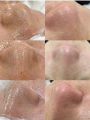 -SOS修丽可.痘肌修复中心