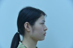 体验前-Yestar艺星整形美容医院