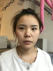 -广东韩妃整形外科医院
