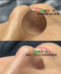 -LUNA皮相美·骨相美高级美感
