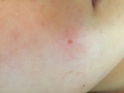 -VON半永久眉学设计