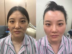 -洁铭新加坡医美
