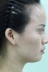 -圣嘉新医疗美容医院