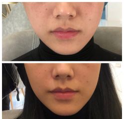 点击看大图 -深圳美莱医疗美容医院