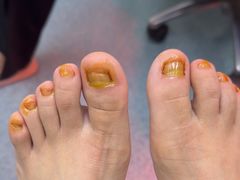 -新甲连锁灰指甲·甲沟炎·鸡眼(黑龙江路店)