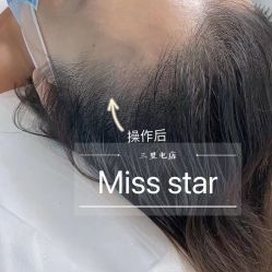 -MISS STAR·半永久纹眉·发际线·美瞳线