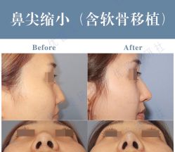 -丽都整形美容医院·全国连锁旗舰店