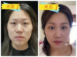-素美医疗美容·西南眼鼻整形·修复基地
