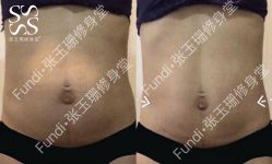 -Fundi张玉珊修身堂·indiba·BTL科技瘦身