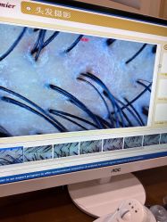 -丝客富脱发养发头皮馆