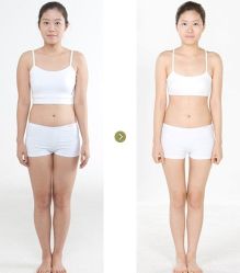 -CMS西美斯·美式医疗美容