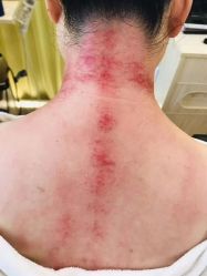 -希梵尔头皮抗衰·科技养发