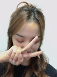 -大麦微针植发丨全国连锁