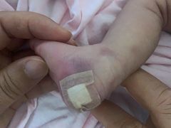 -天津市第三中心医院