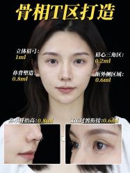 点击看大图 -Yestar艺星整形