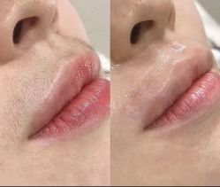 -美愈美肤MEIYU SKIN